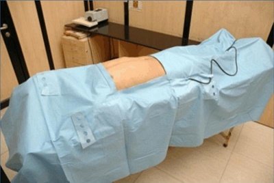Laparoscopy Drape